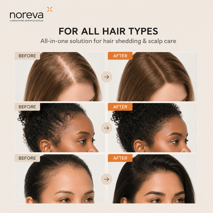 Noreva - Korean Hair Growth Serum